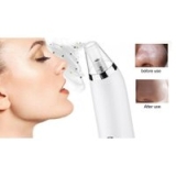 Blackhead-Removing Skin Cleanser With 3 Heads – 2 Colours for only £14.99